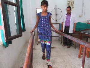 Vibya learning to walk with foot-drop